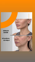 hyarülonik asit